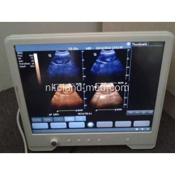 Draagbare Ultrasound Scanner Digitale echografie Machine Prijs